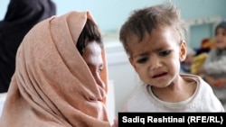 په کندهار کې د خوارځواکۍ ښکار ماشوم د درملنې لپاره په روغتون کې دی ـ انځور له ارشیفه. 