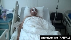 Nagorno-Karabakh - Hayk Khanumian, a Karabakh opposition politician, receives medical treatment in a Stepanakert hospital after being assaulted by a group of men, 6Jun2016.