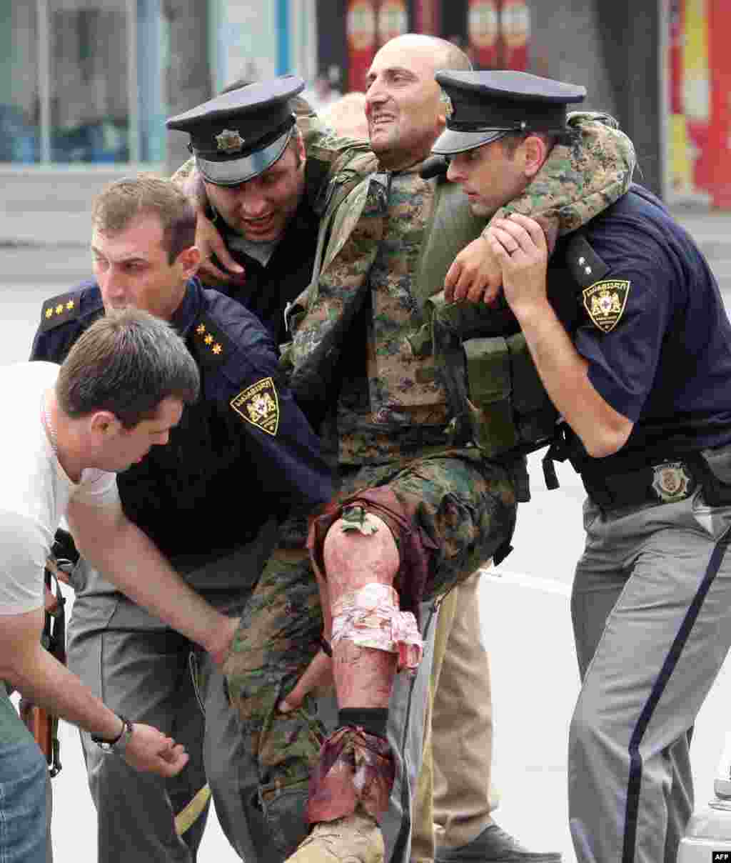 Полицейские оказывают помощь грузинскому солдату, раненому в бою с южноосетинскими сепаратистами в Гори. 8 августа 2008 года 